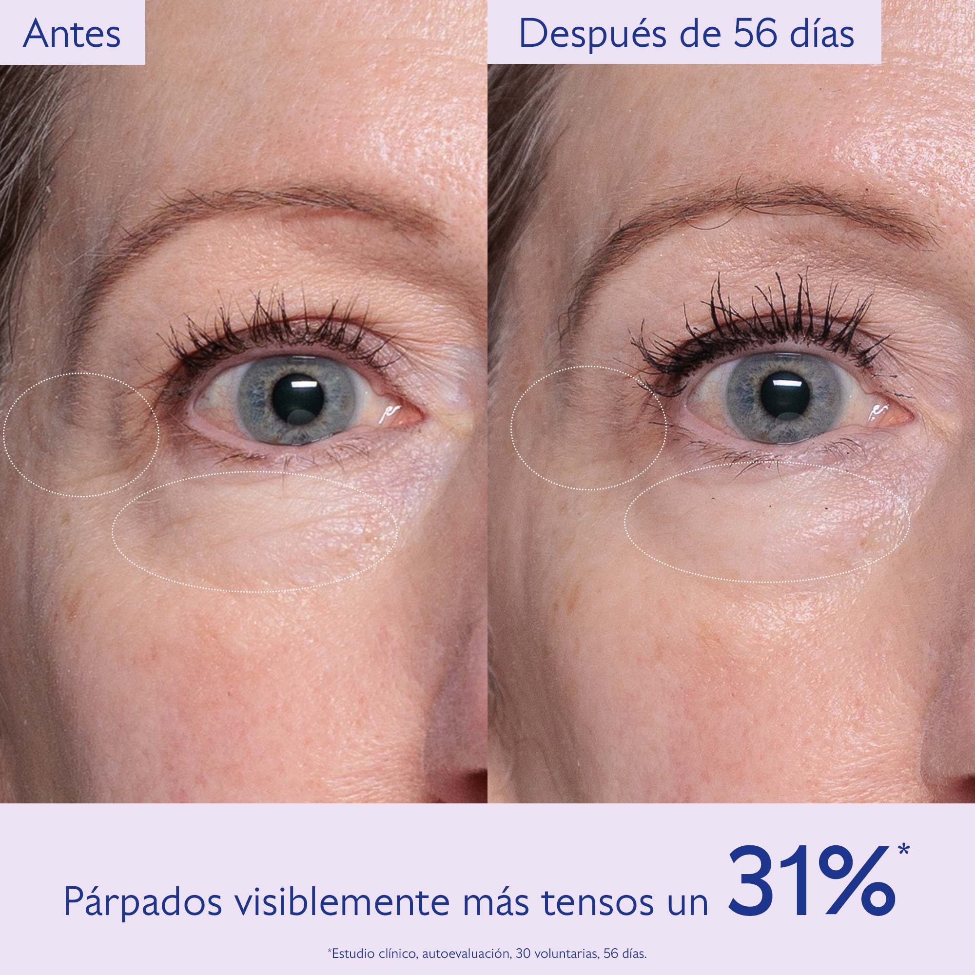 RESVERATROL-LIFT EYE GEL (CREMA REAFIRMANTE DE OJOS)